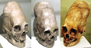 Three Paracas Necropolis Culture skulls, showing different shapes produced by head binding