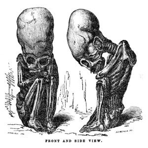 A foetal mummy, illustrated by Rivero and Tschudi